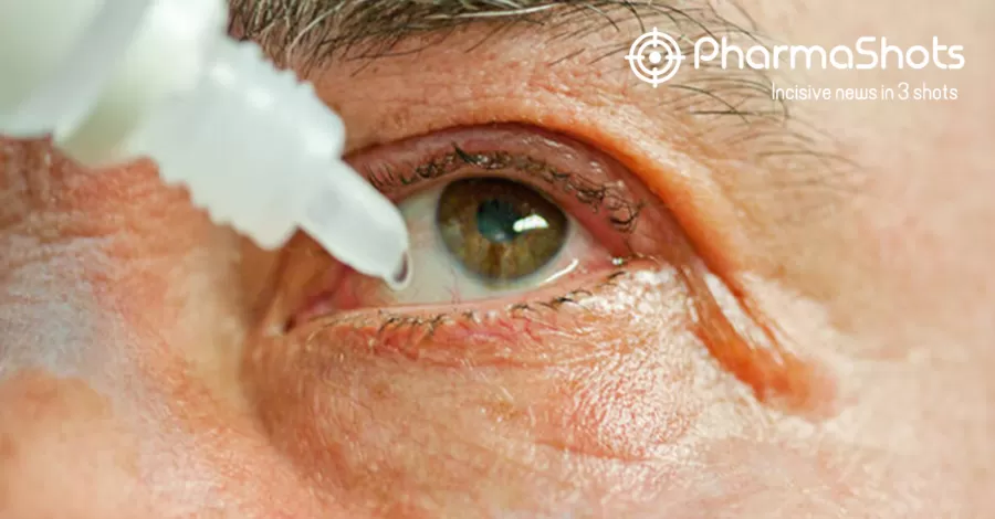 Preventing Eye Infections: Tips for Keeping Your Eyes Healthy